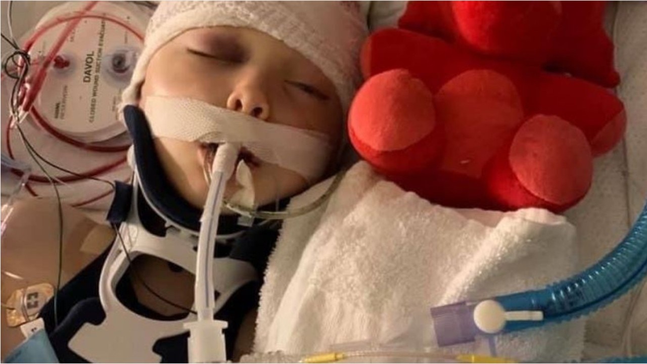 7-year-old recovering from attack that left him with a fractured skull