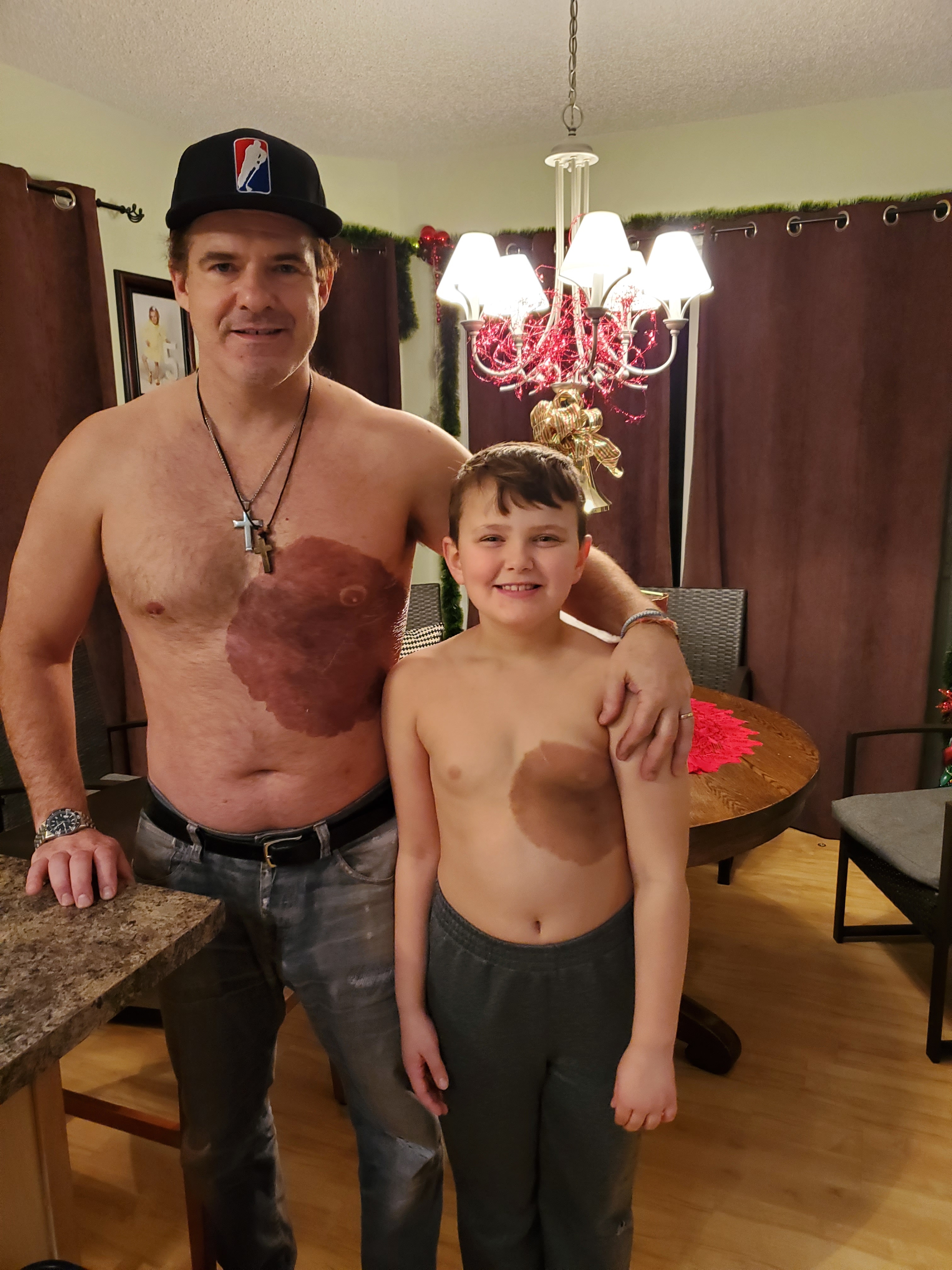 Dad gets matching tattoo to match his 8 year old son feel confident about his birthmark.