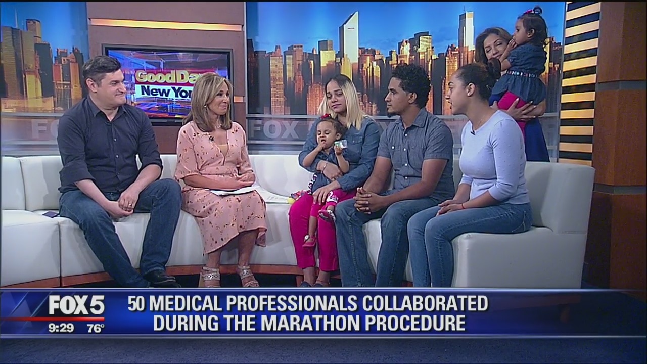 Formerly conjoined twins visit GDNY