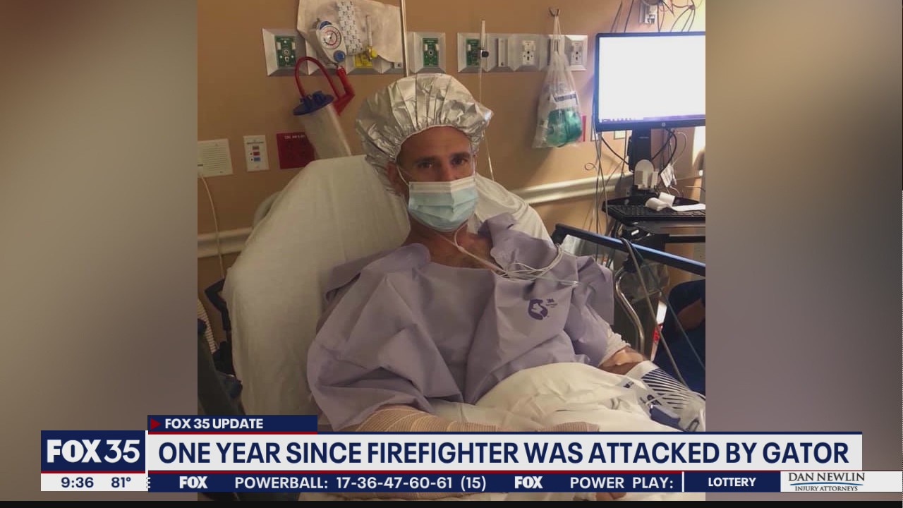 One year since Central Florida firefighter nearly lost arm in alligator attack