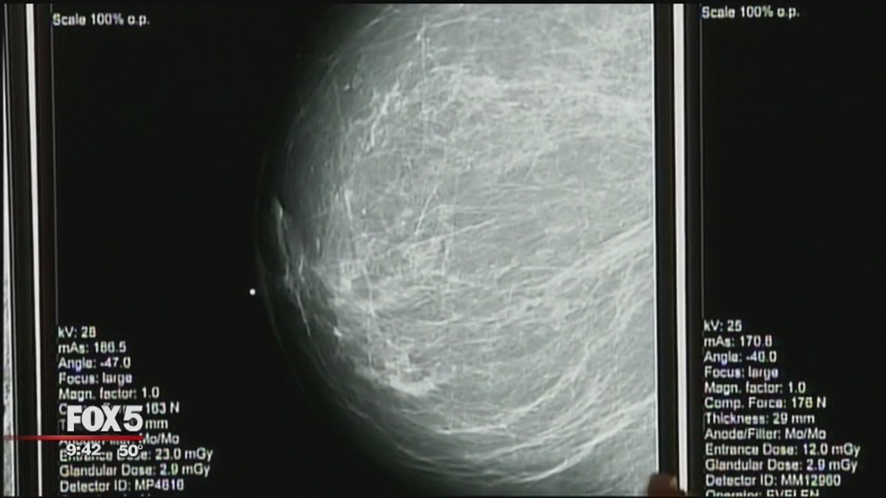 New type of mammogram