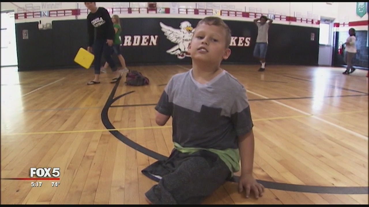 Jaxon Prosthetic Surprise