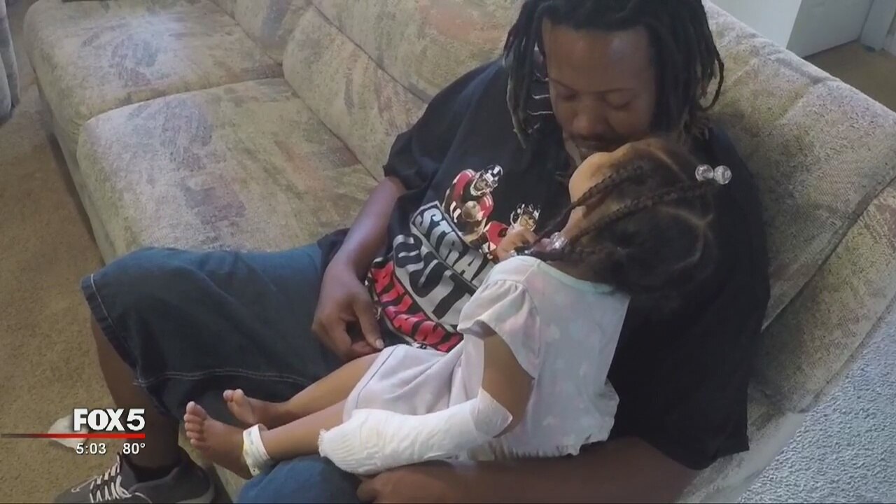 Police investigate young girl burned