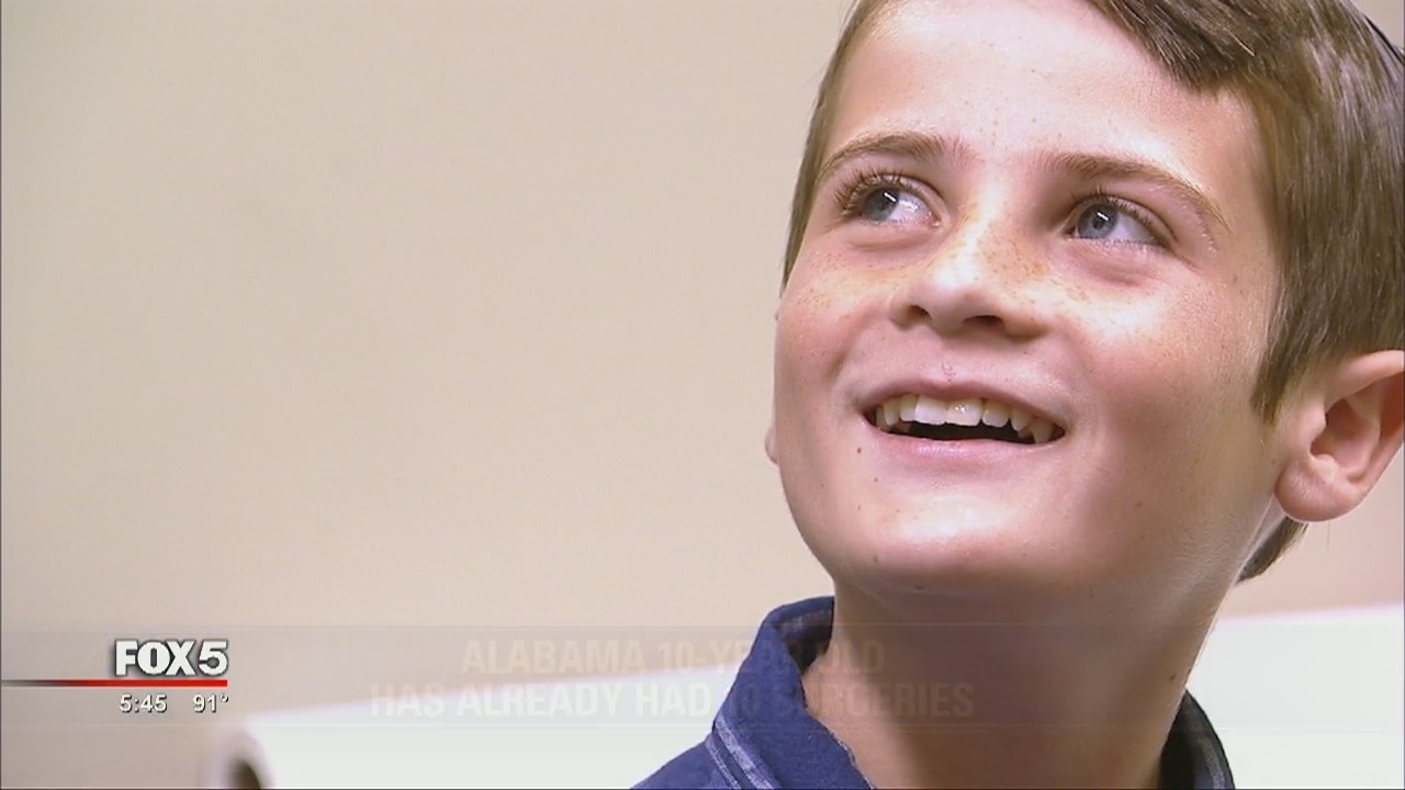 Alabama 10-year-old already has had 10 surgeries