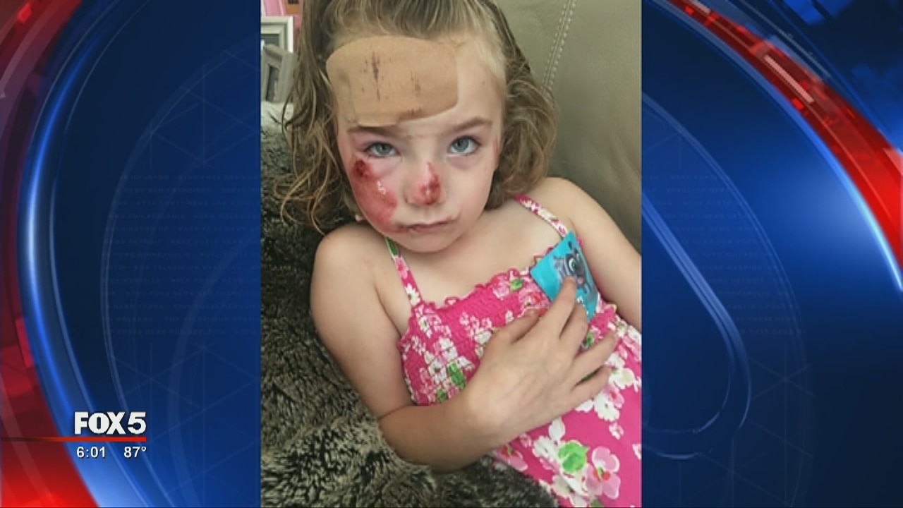 Little girl hit by bicyclist