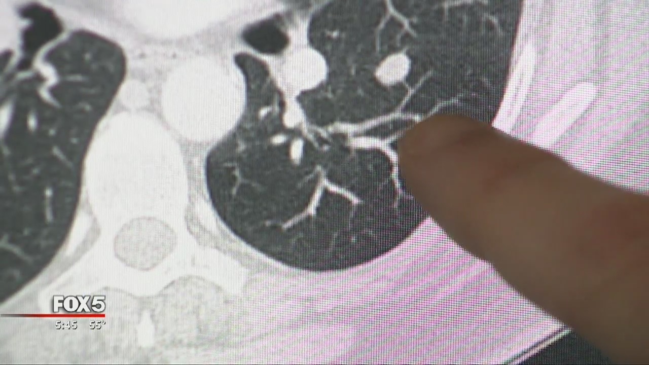 Facing hard diagnosis, woman finds home in study