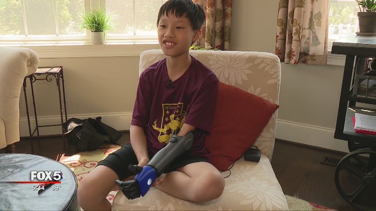 Boy's new prosthetic arm