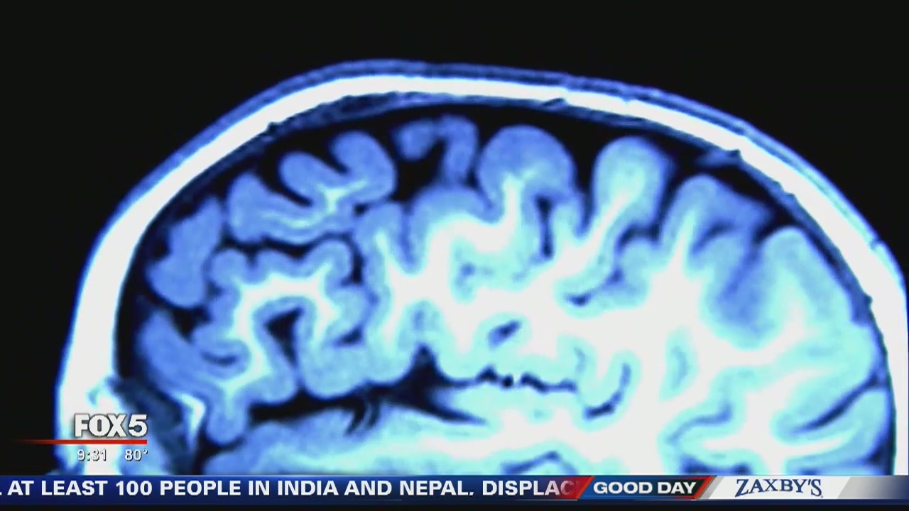 How to spot memory loss