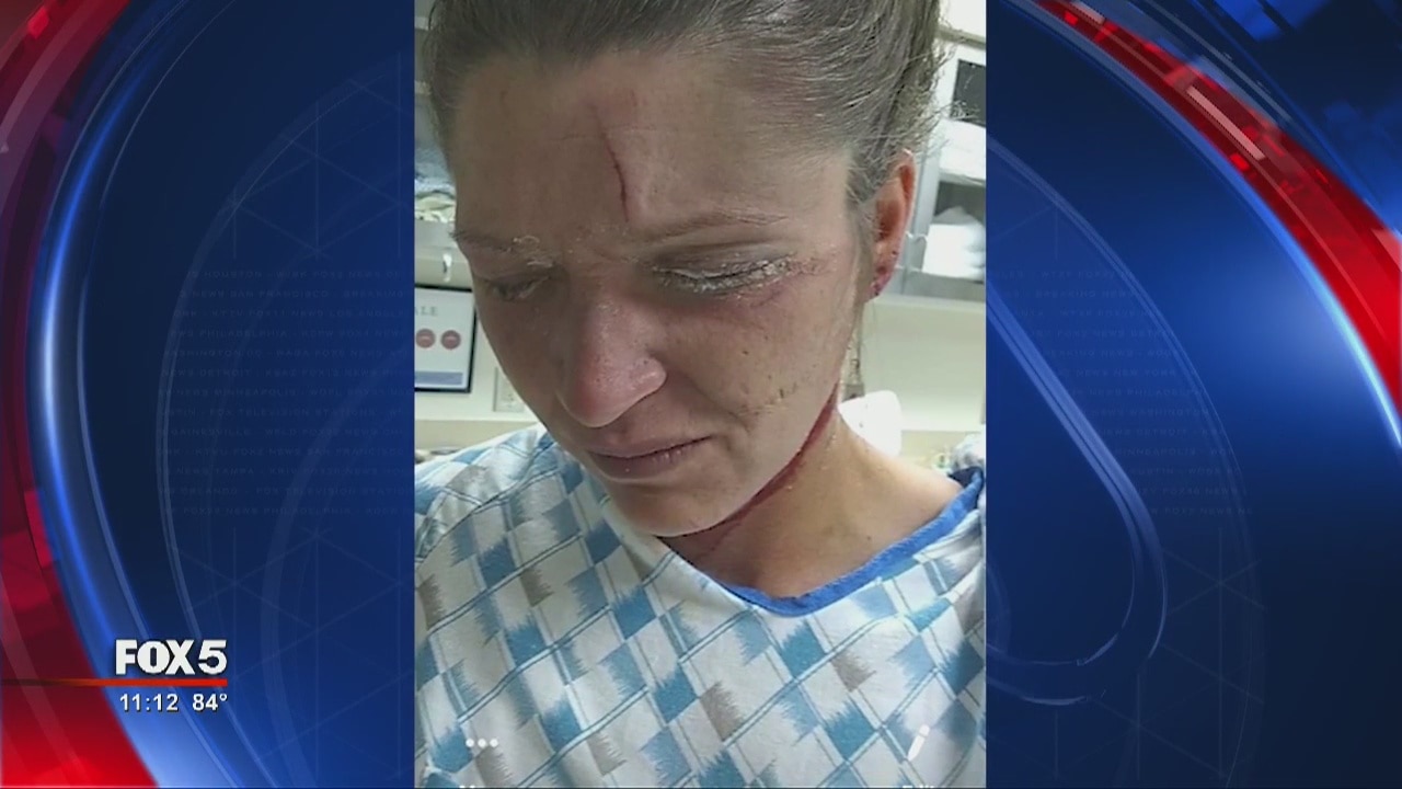 4 arrested after fight, including one woman whose eyes were glued shut