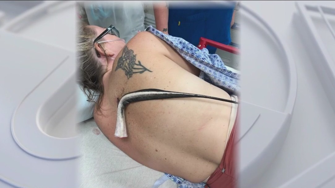 Across America: Stingray attack