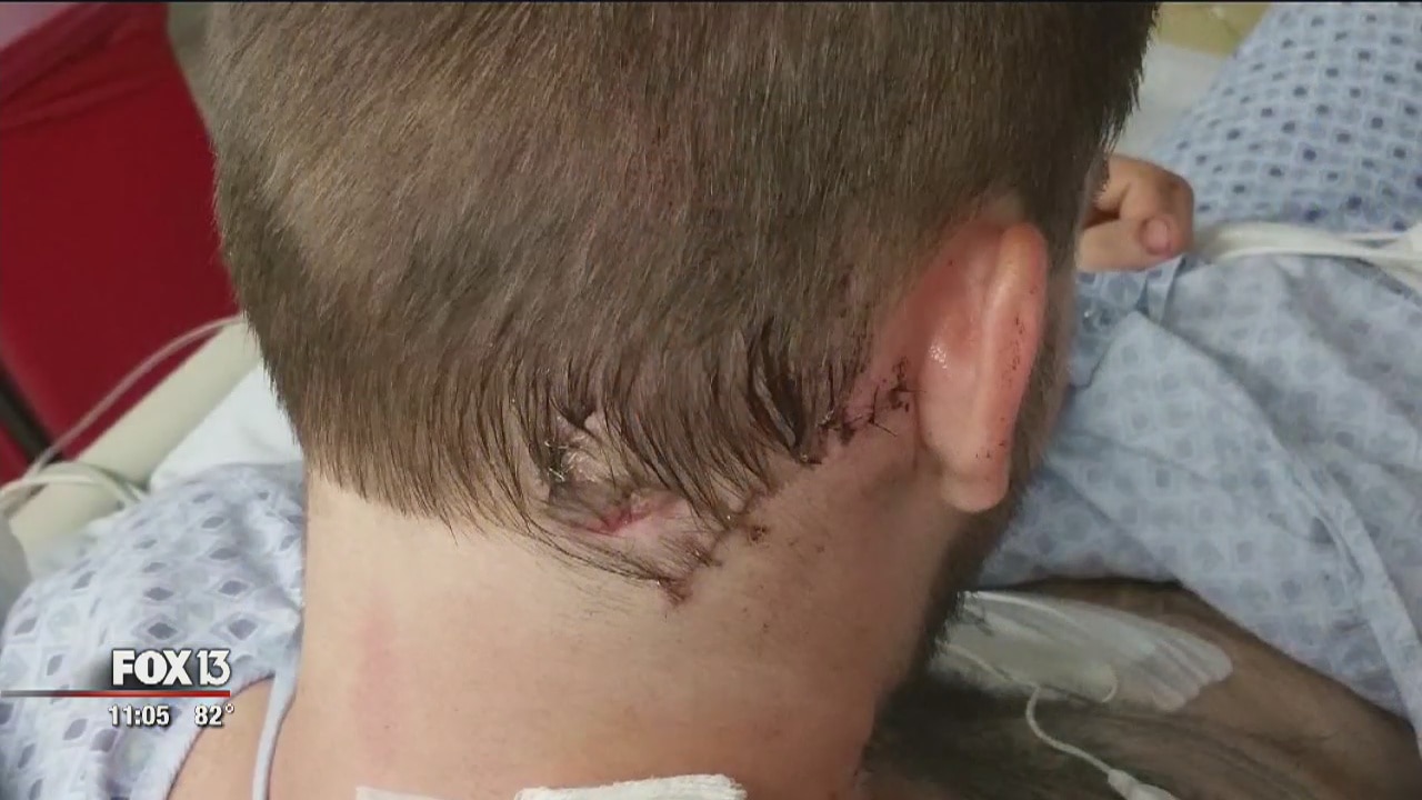 Victim recovering after being lured, stabbed