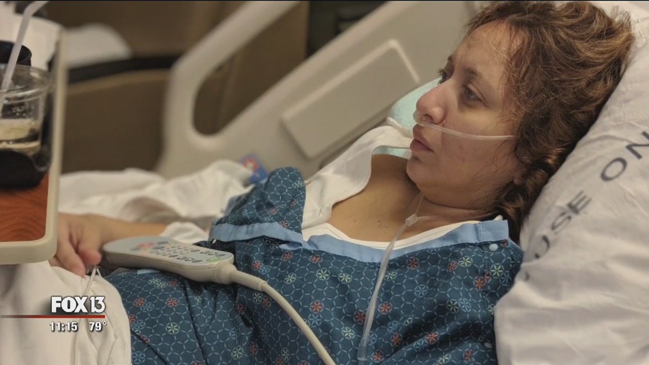 Donations pour in for woman to have reconstructive surgery