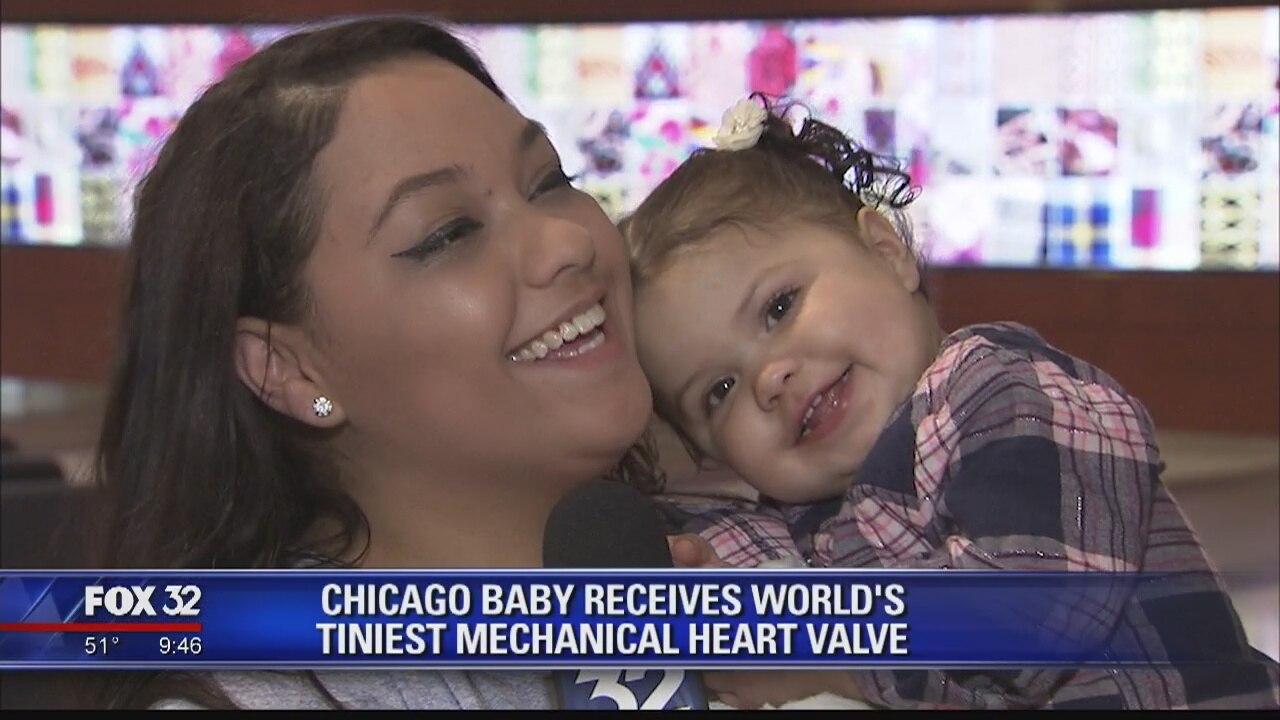 Chicago baby receives world's tiniest mechanical heart valve