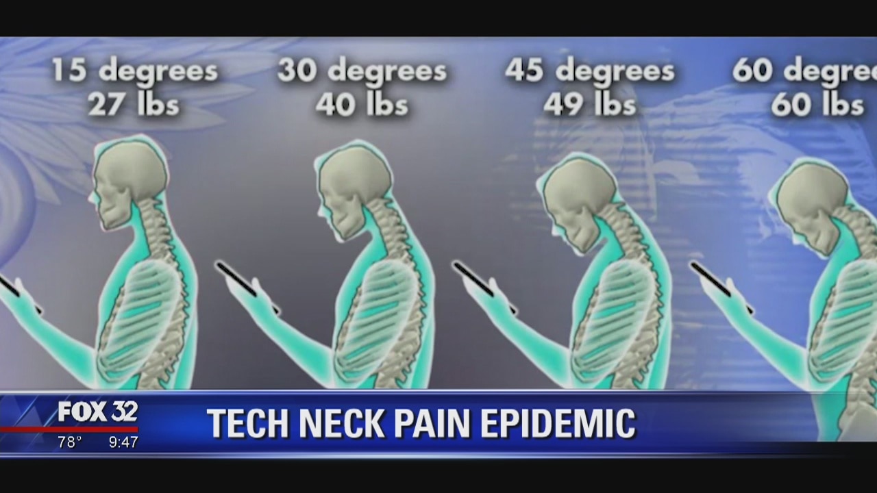 'Tech neck' pain epidemic striking people of all ages