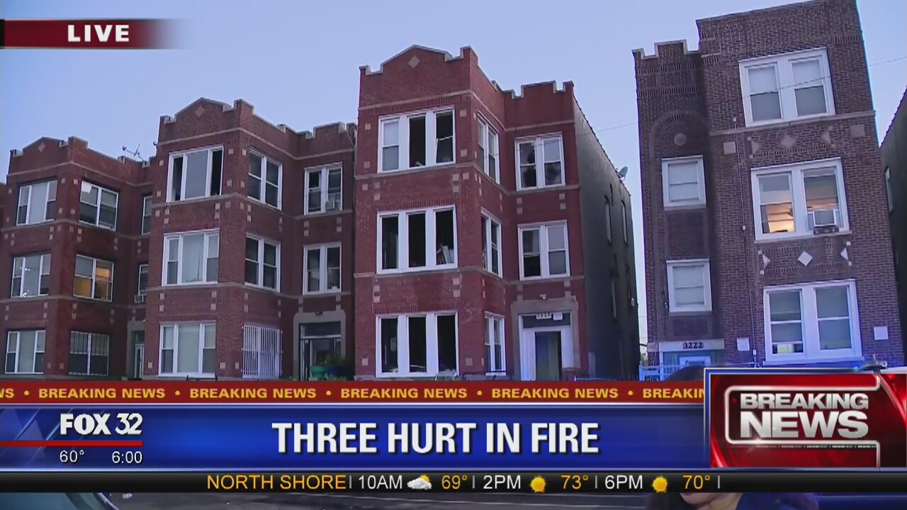 Fire injures 4, displaces 20 in Humboldt Park