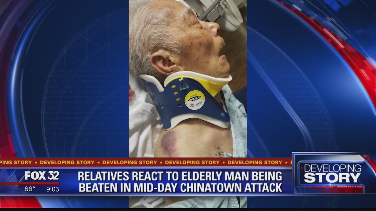 91-year-old man attacked while walking to coffee shop in Chinatown