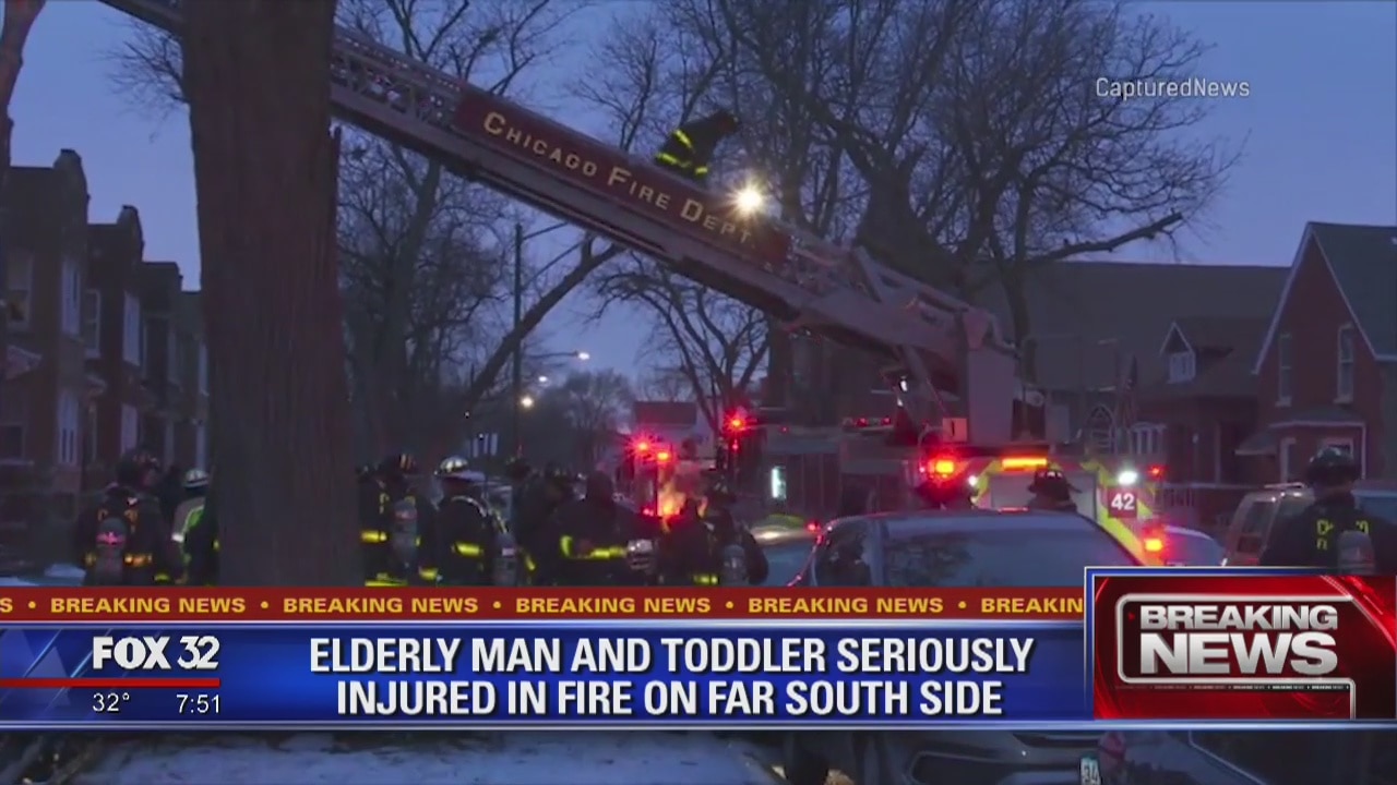 Toddler, 94-year-old man hurt in Burnside fire