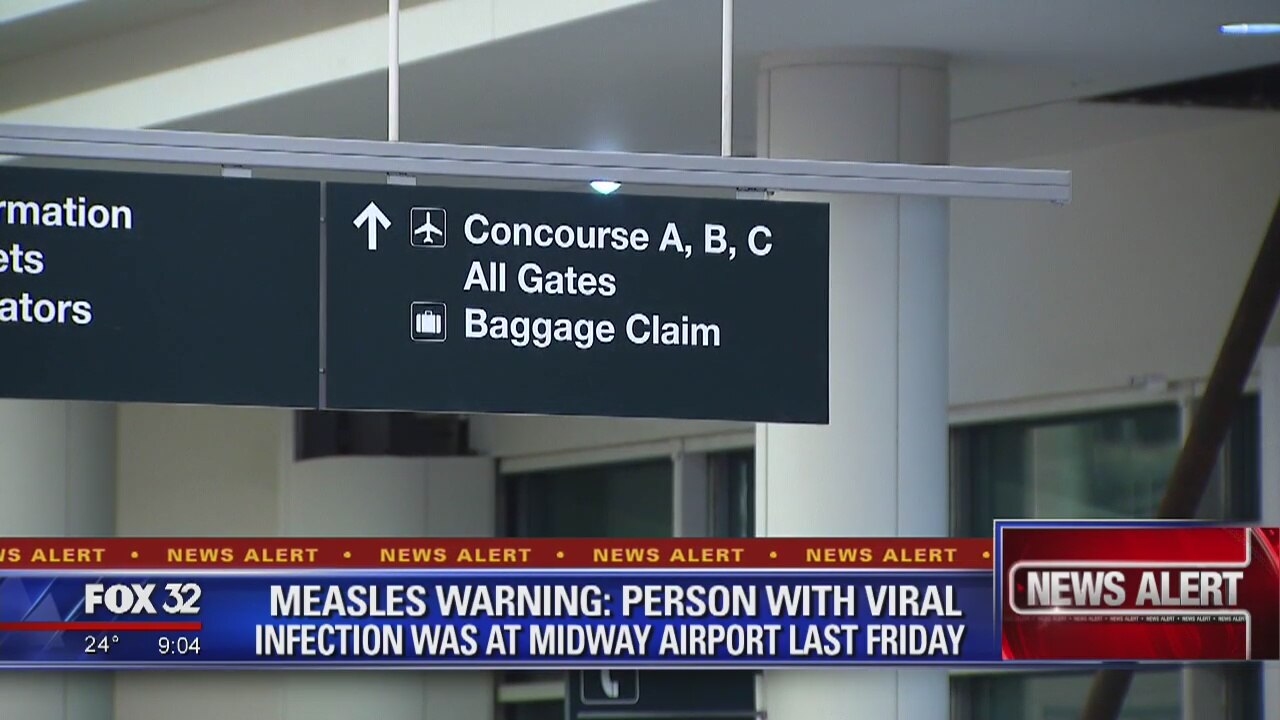 WARNING: Potential measles exposure at Midway Airport, suburban hospital
