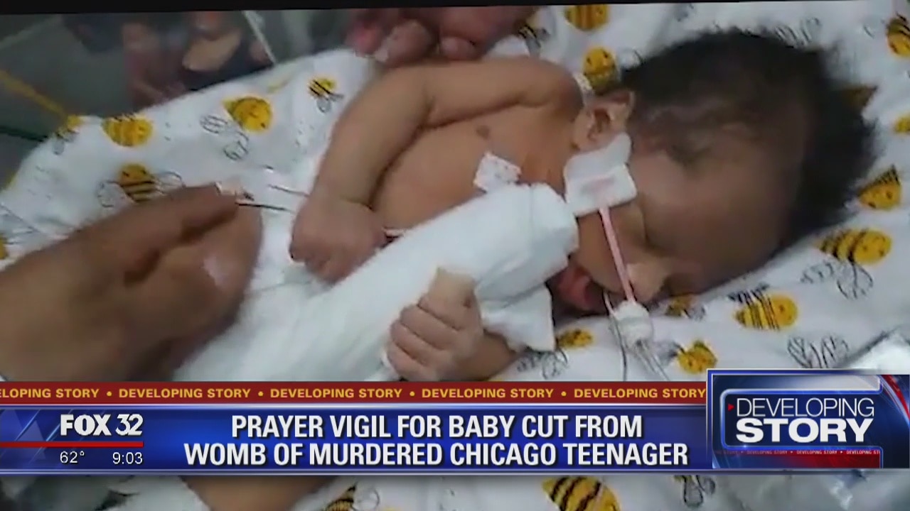 Prayer vigil held for baby cut from womb of Marlen Ochoa-Lopez