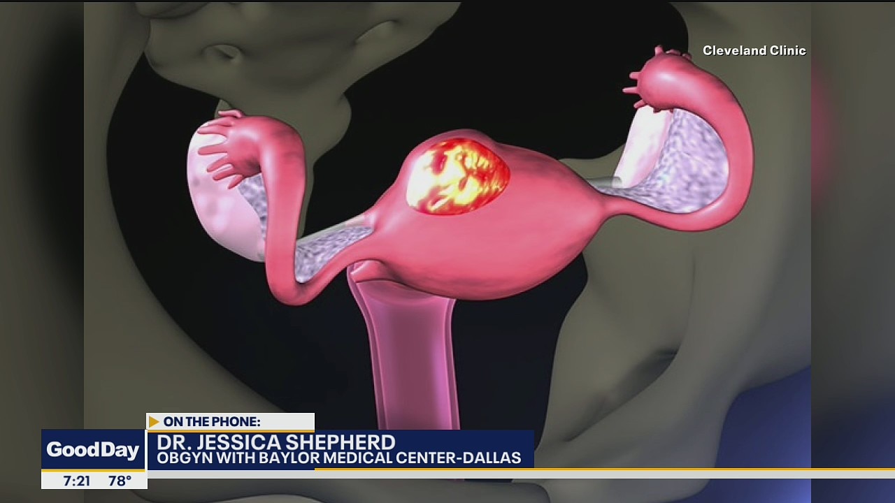 Fibroid Awareness