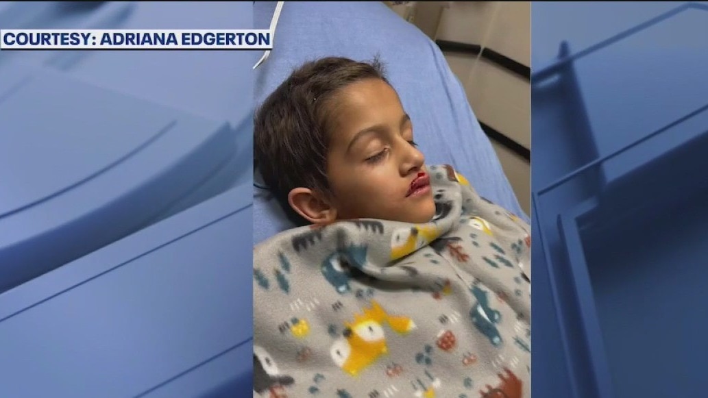Across America: Child seriously hurt at drone show