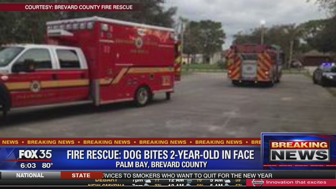 Fire Rescue says dog bit child in face
