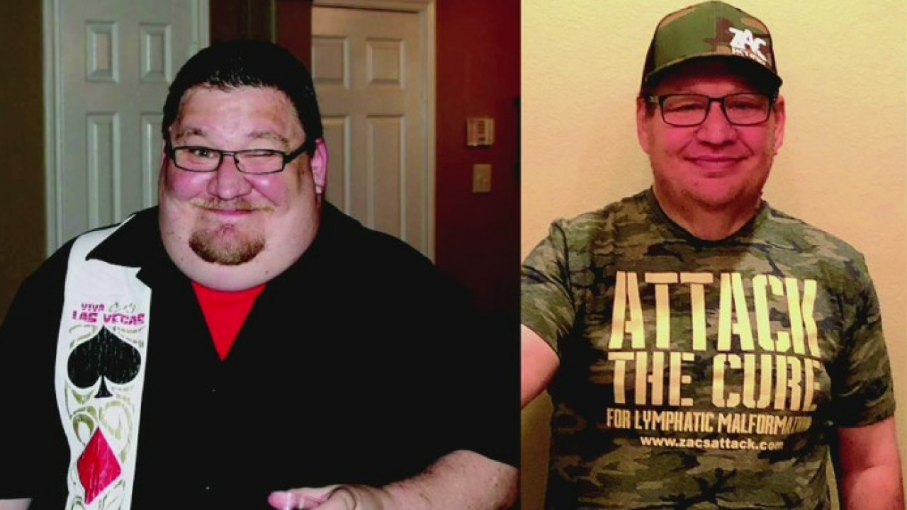 Local man shares story behind his weight loss journey