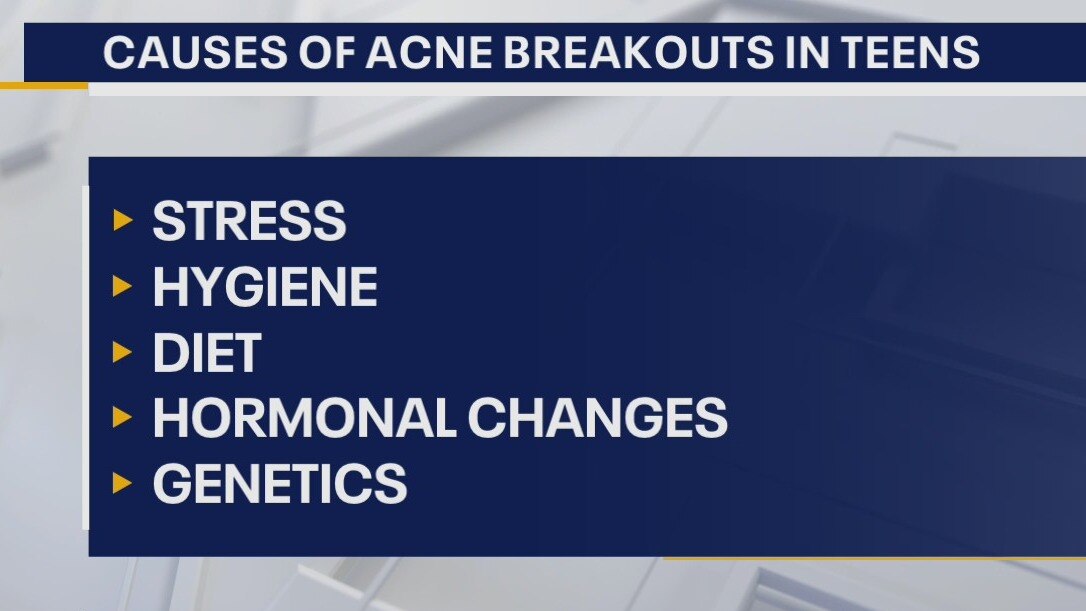 Treating and preventing back-to-school breakouts