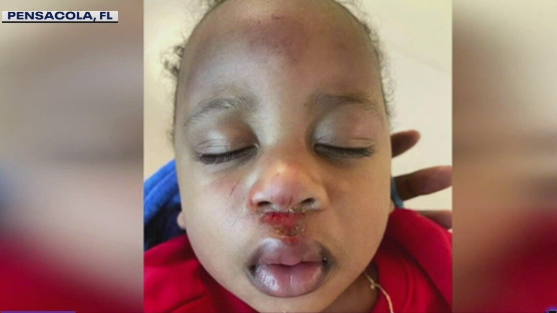 Florida police department under investigation after baby was seriously hurt in their care