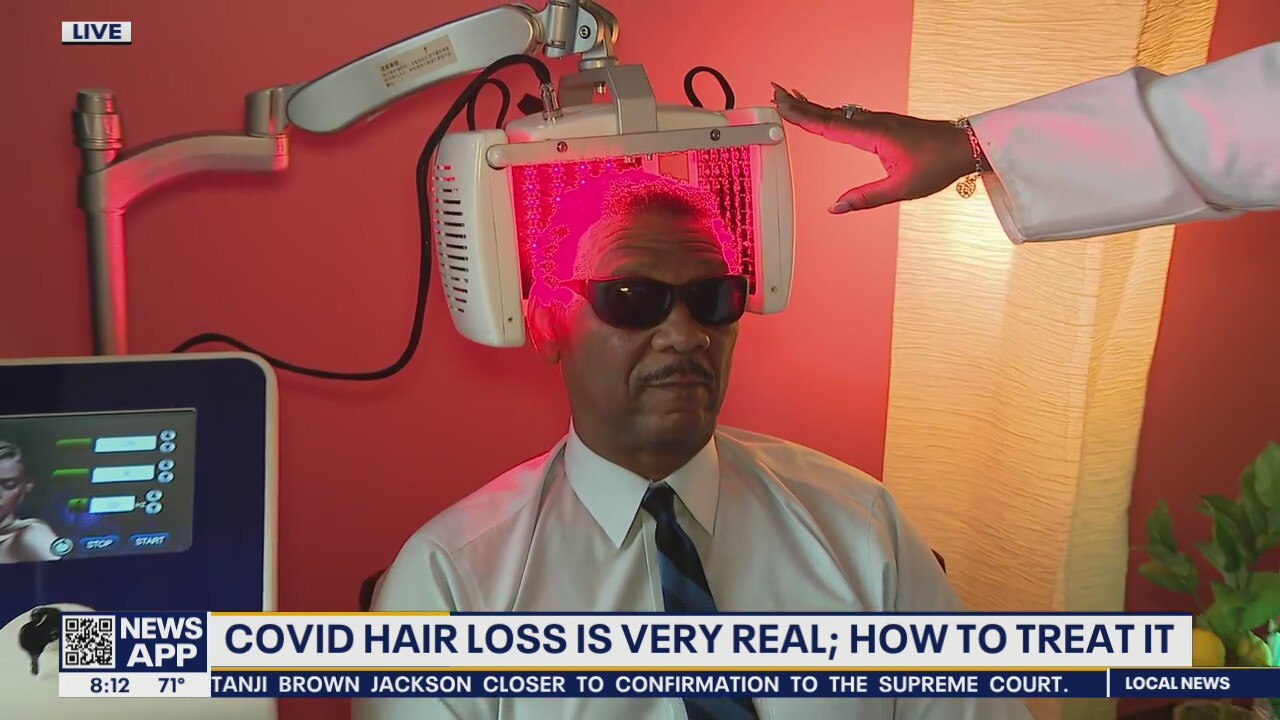 Local doctor explains "COVID alopecia" and how to treat it