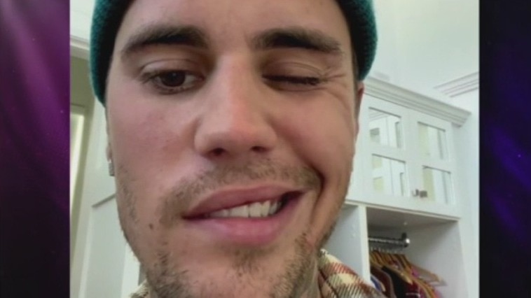 Justin Bieber postpones tour after Ramsay Hunt Syndrome Diagnosis