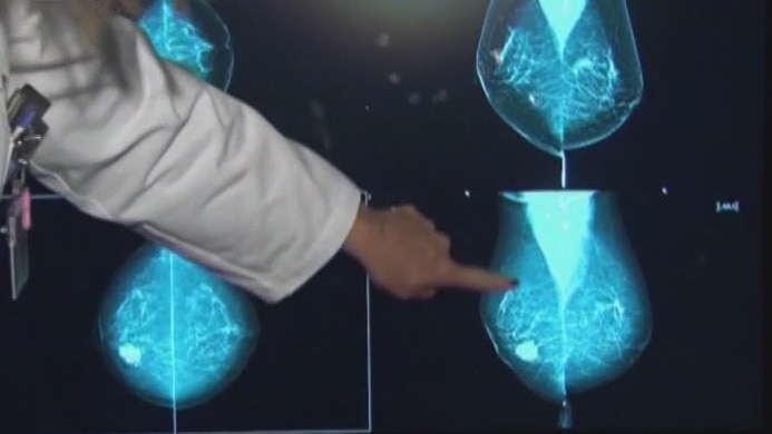 Key insights on screenings during Breast Cancer Awareness Month