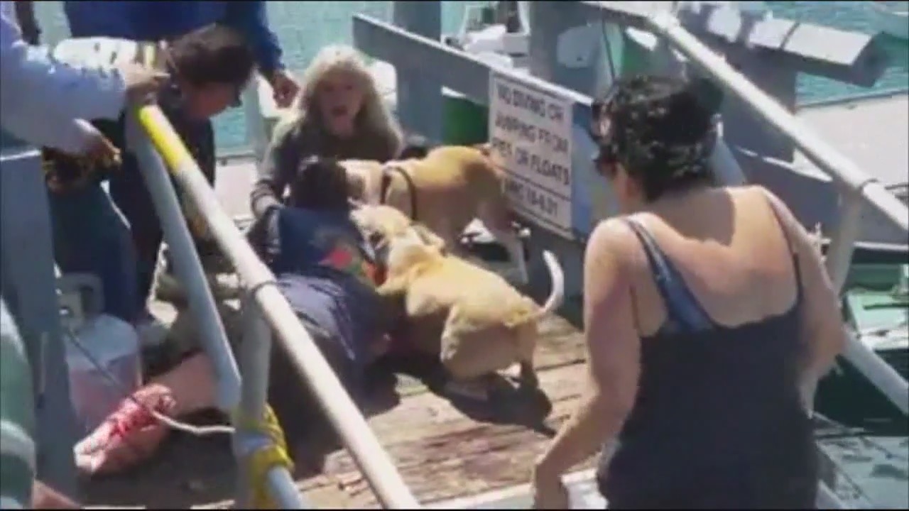 Pit Bull attack in Catalina