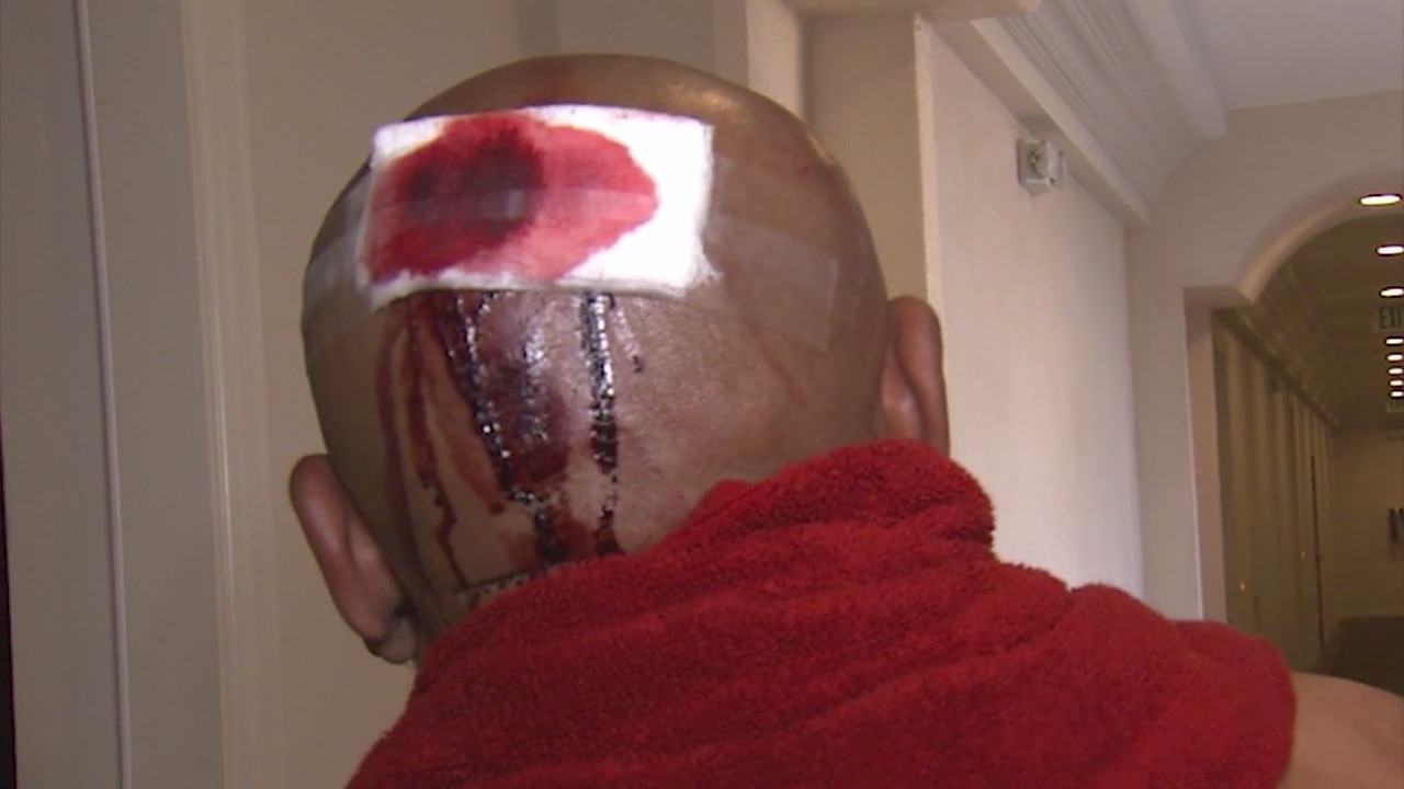 Hawthorne resident attacked by masked men