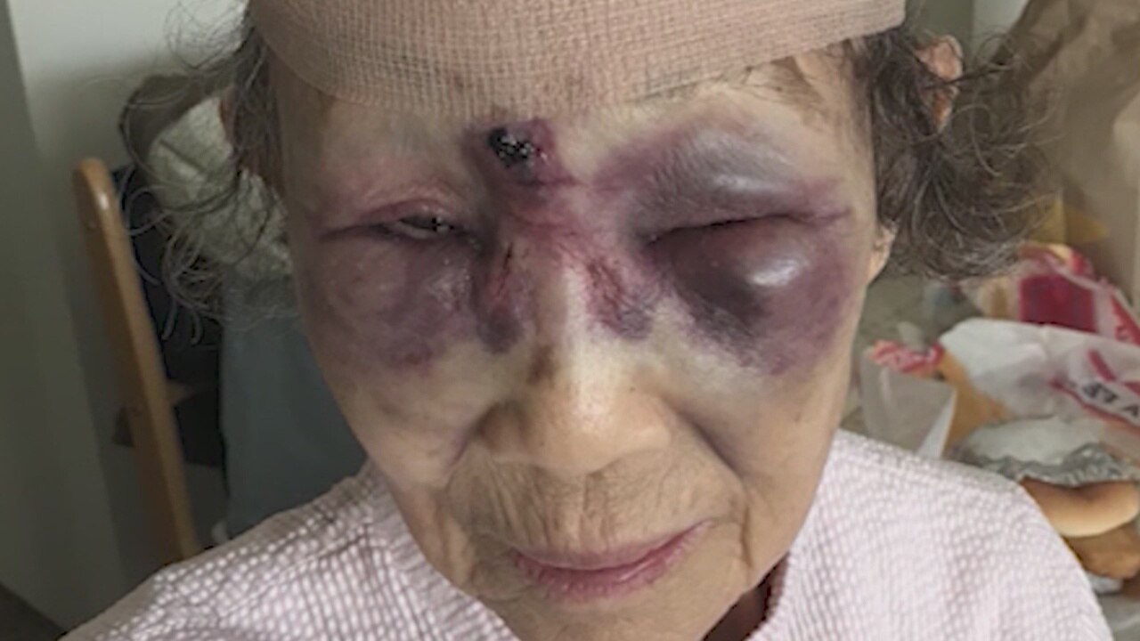 Suspect sought after 86-year-old grandmother attacked