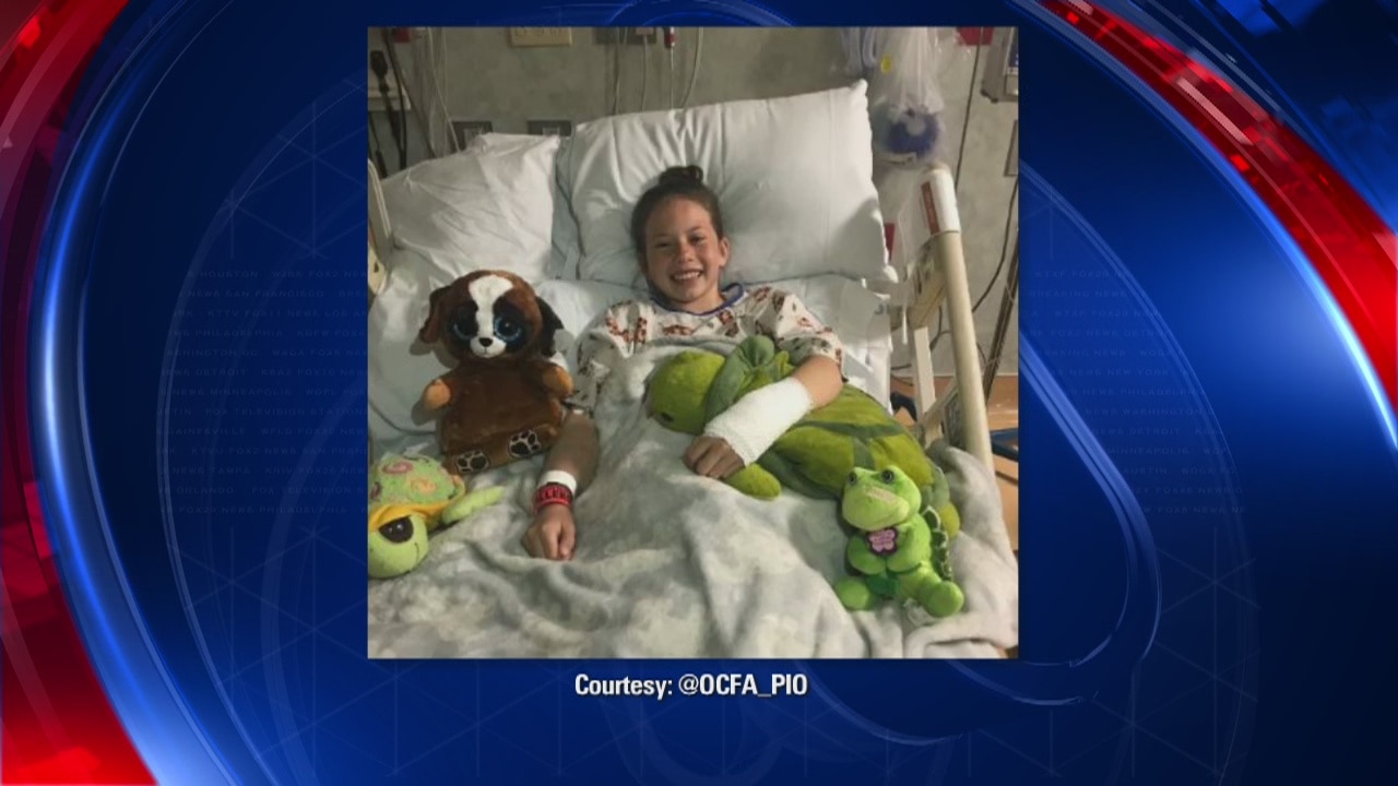 Girl burned by fire pit in Newport Beach