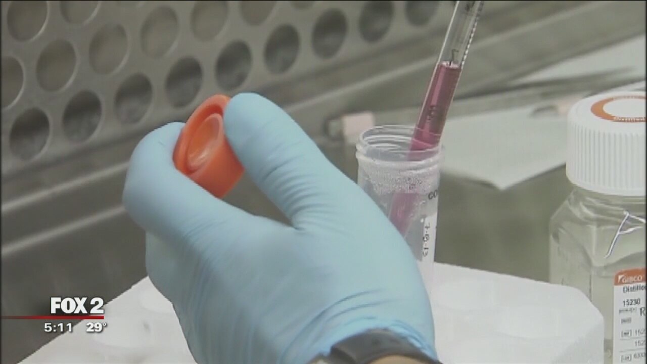 Hepatitis A outbreaks surge in metro Detroit, possibly linked to opioids