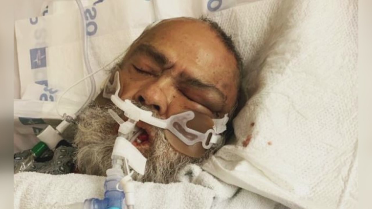 Elderly man dies after being severely beaten by his hospital roommate