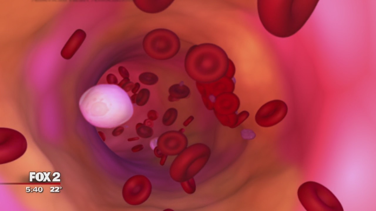 Body fat percentage can tell you about risk of heart disease