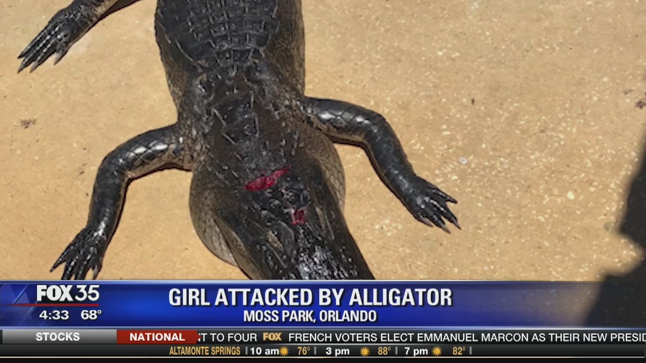Girl attacked by alligator
