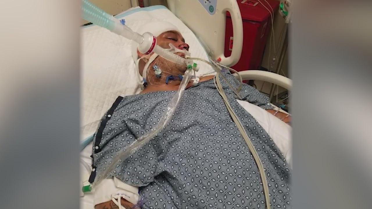 Family demanding answers after they claim son was beaten by San Bernardino deputies