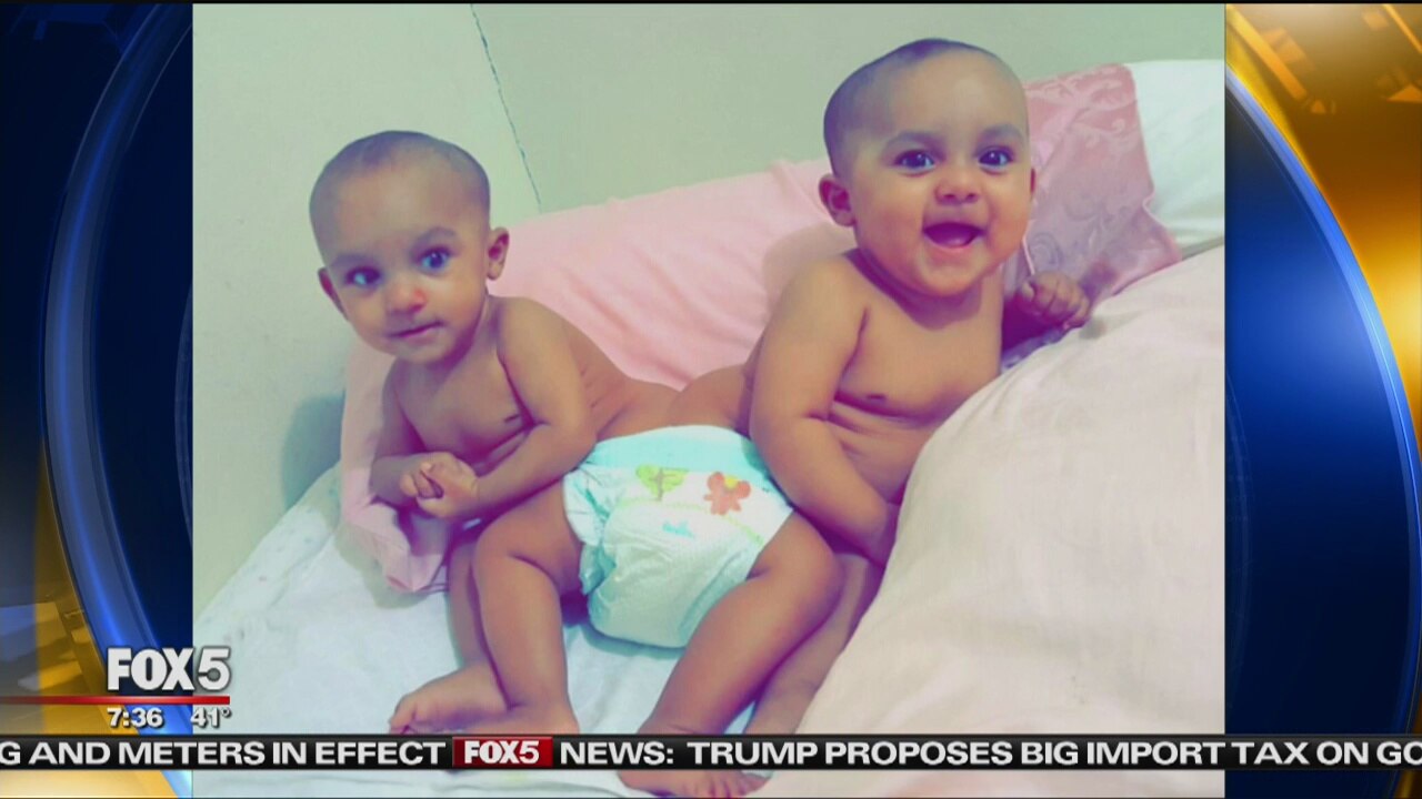 Surgeons Separate Conjoined Twins