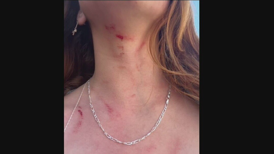 16-year-old girl attacked in Long Beach