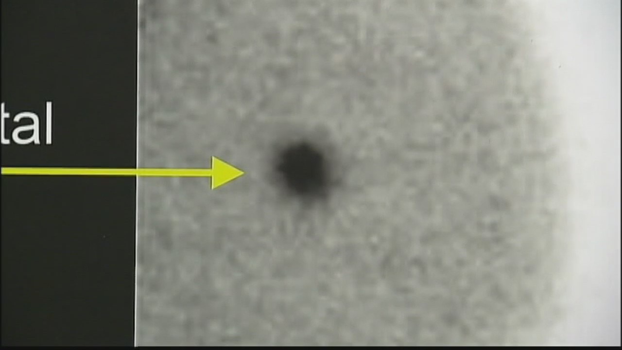 Company develops new screening that searches for up to 50 types of cancer