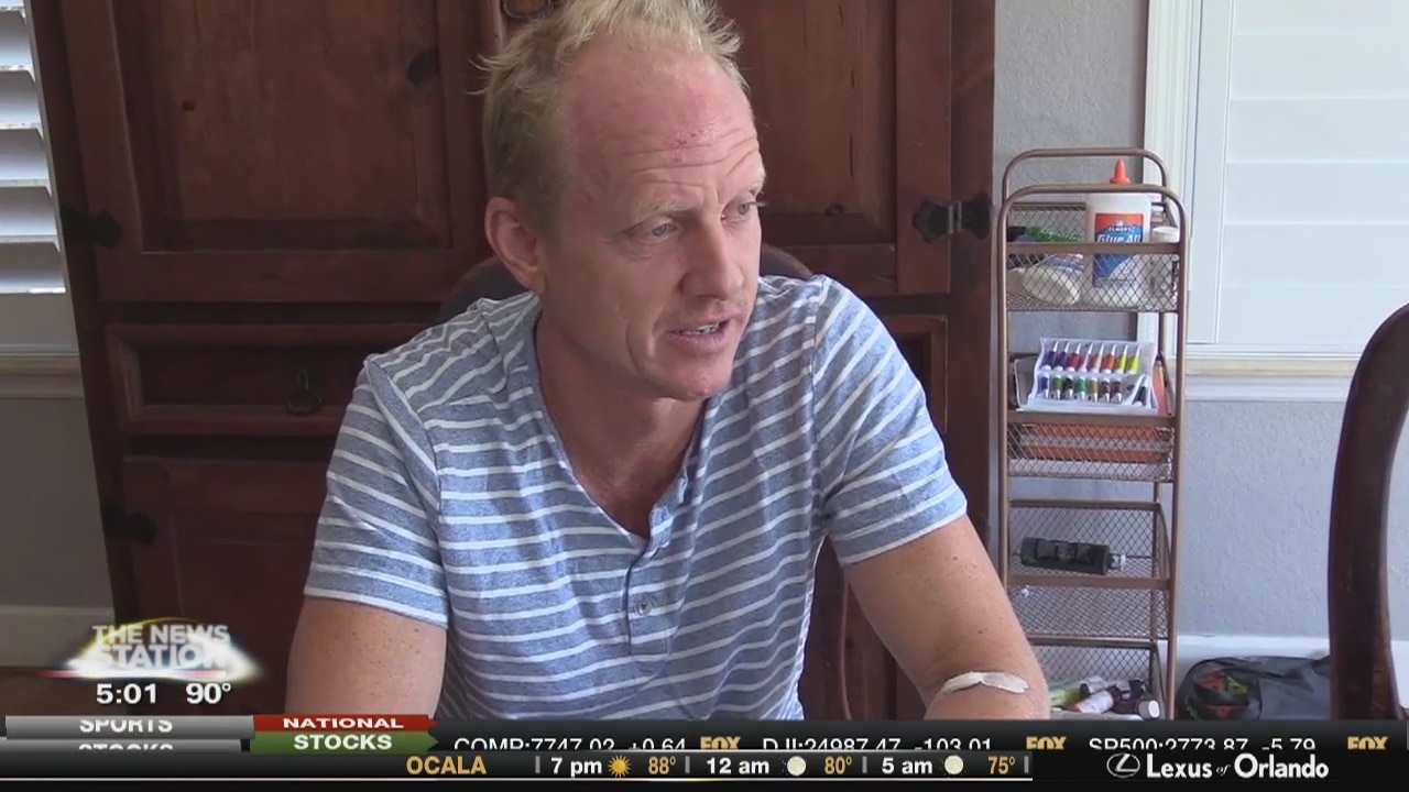 Lightning strike victim talking to Fox 35