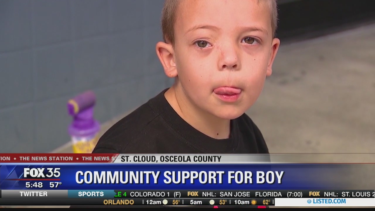 Community rallies for boy injured in accidental shooting