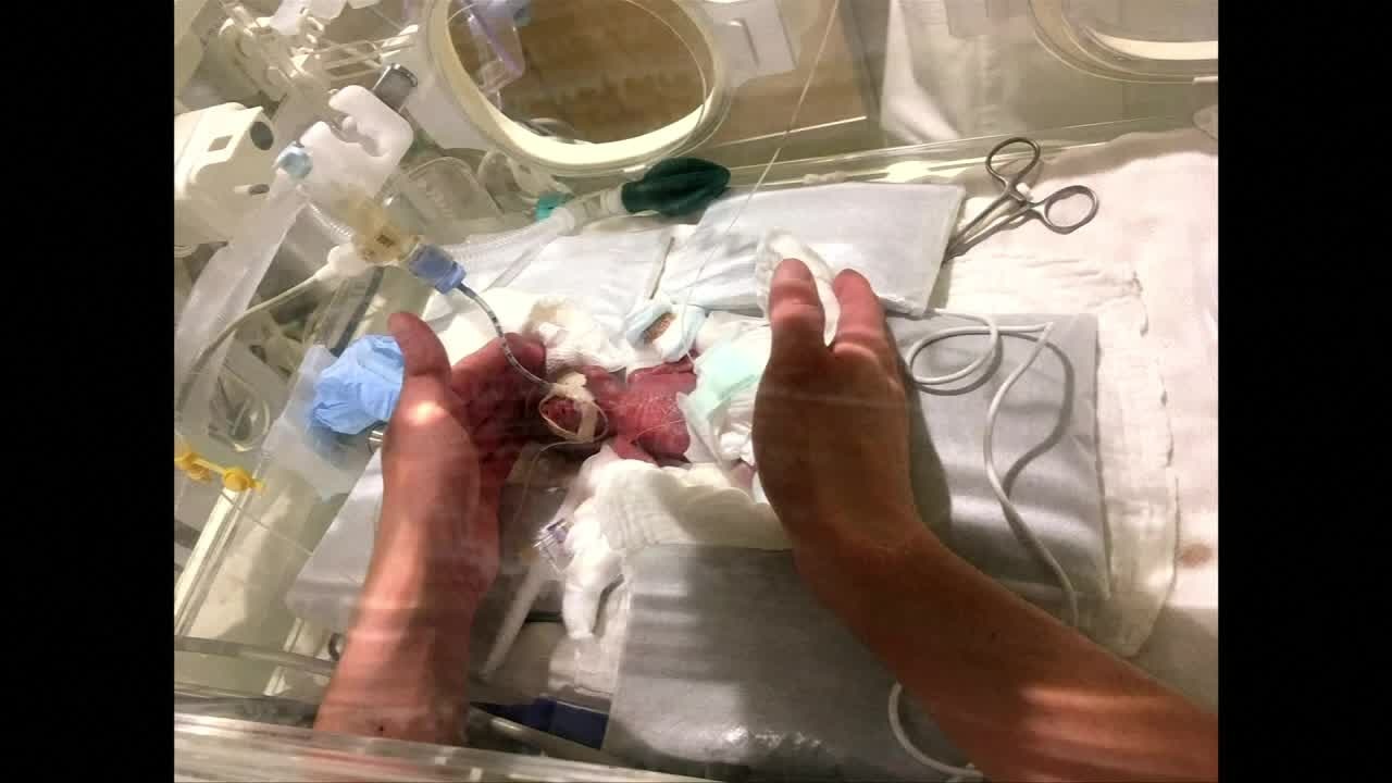 World's smallest baby goes home
