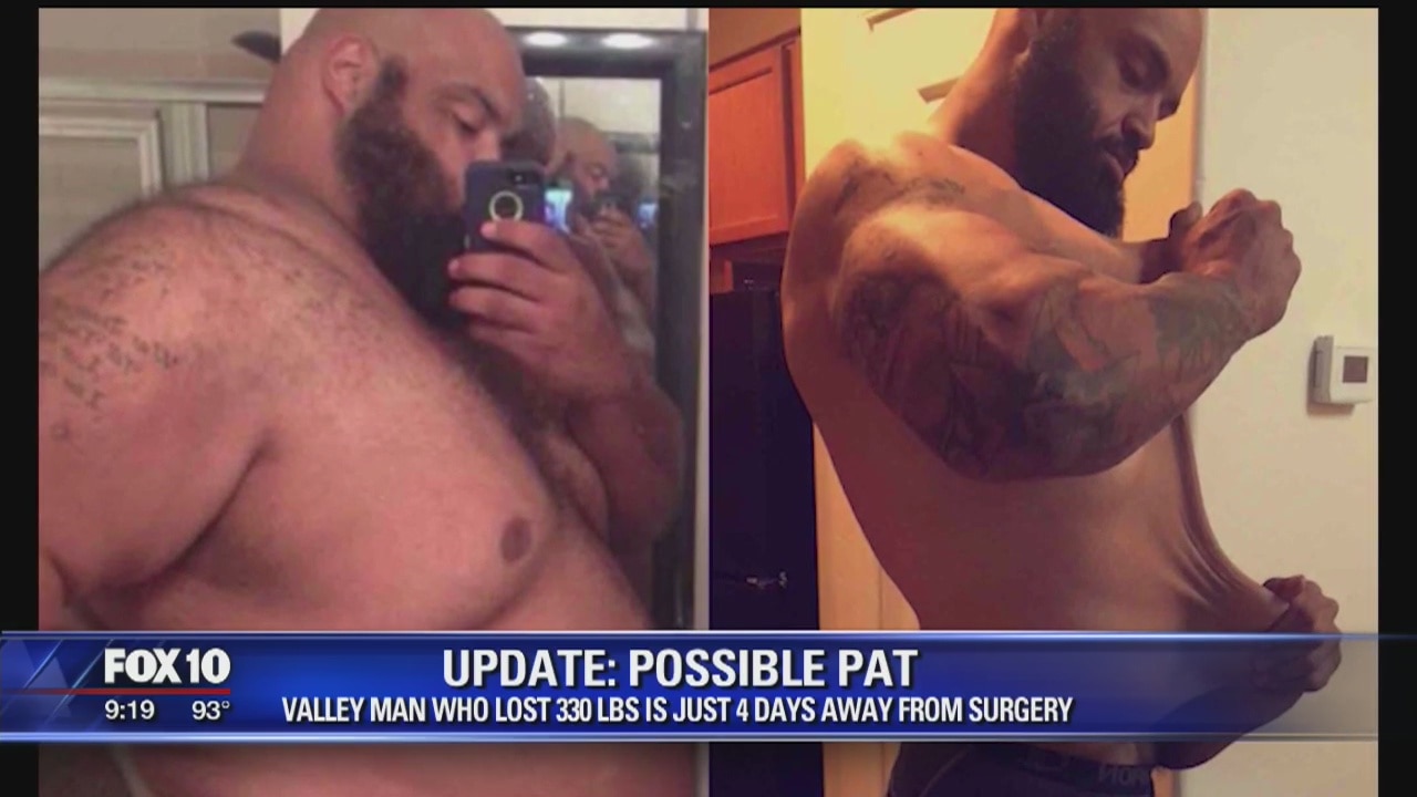 Possible Pat's incredible weight loss transformation continues