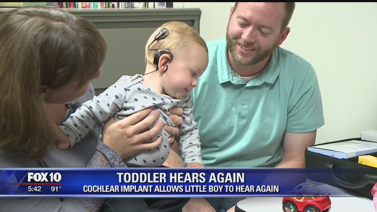 Cochlear implant allows toddler to hear again