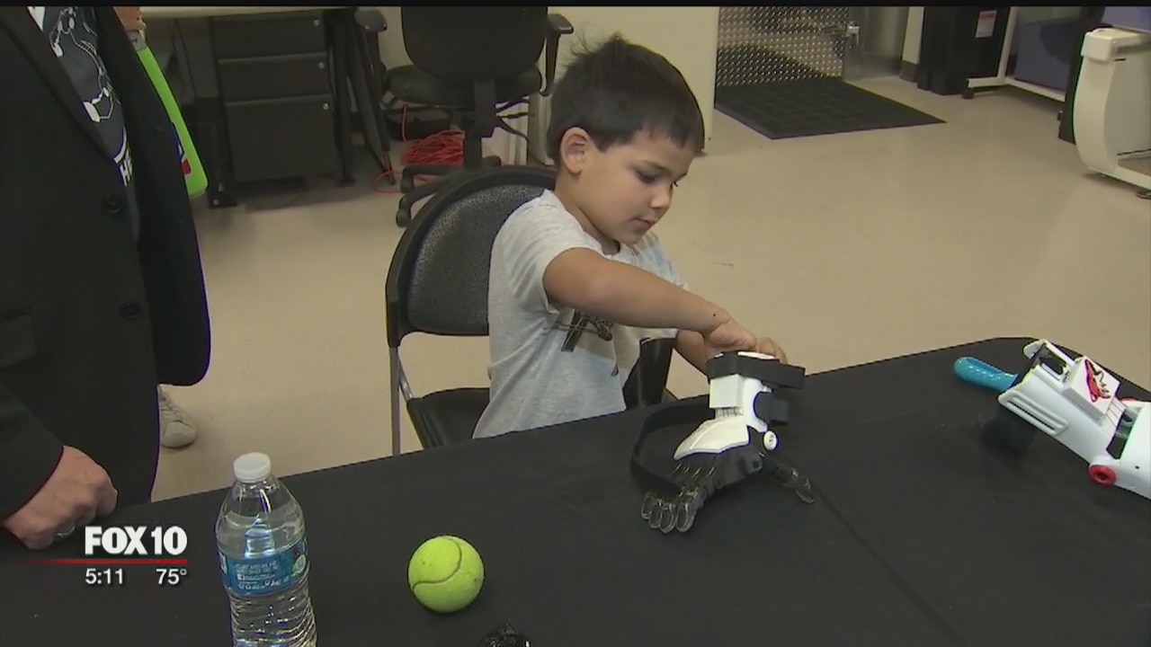 5-year-old boy gets 'Storm Trooper' prosthetic hand